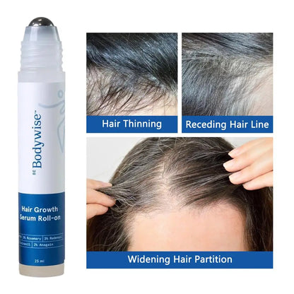 25Ml Rosemary Hair Growth Roller Essence Reduce Hair Breakage Bifurcate Increase Hair Density Nourish Strengthen Toughen