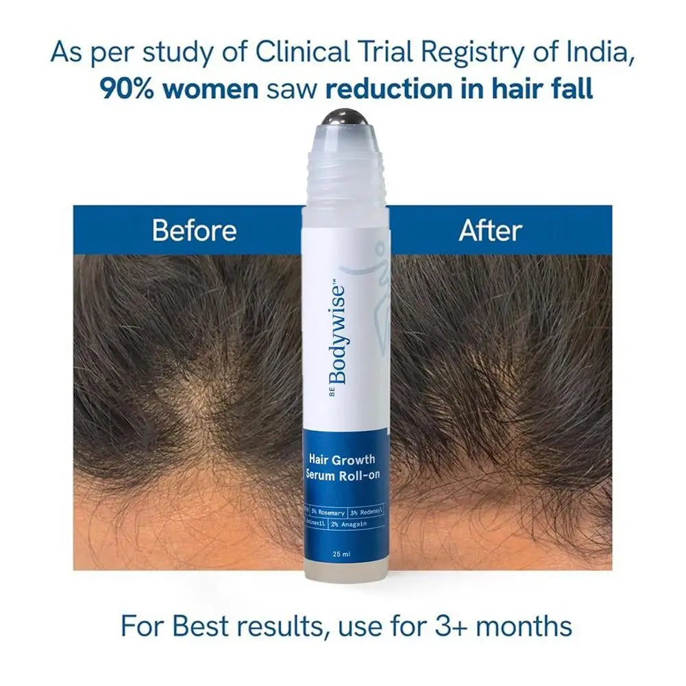 25Ml Rosemary Hair Growth Roller Essence Reduce Hair Breakage Bifurcate Increase Hair Density Nourish Strengthen Toughen
