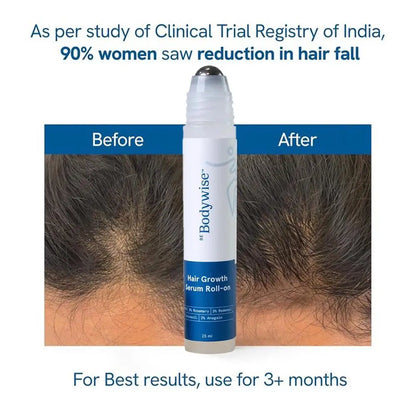 25Ml Rosemary Hair Growth Roller Essence Reduce Hair Breakage Bifurcate Increase Hair Density Nourish Strengthen Toughen